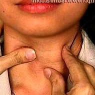 Какие могут быть последствия болезней щитовидной железы