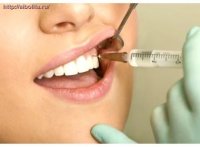Аппликационная анестезия в стоматологии
