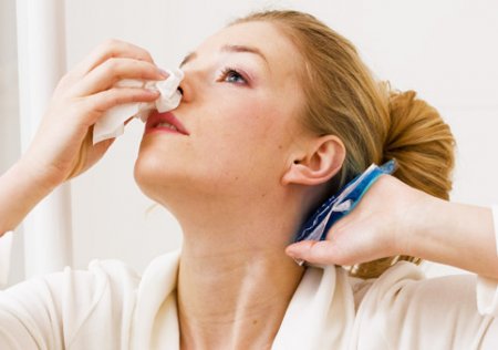 Как остановить кровотечение из носа первая помощь устранения этого недуга