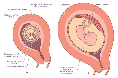 Локализация хориона во время беременности