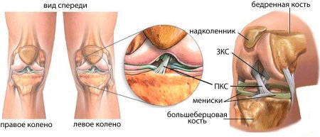 Крестообразная связка коленного сустава и её повреждения