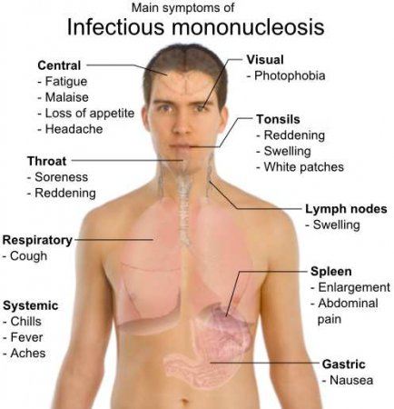 Как передается вирусный менингит симптомы
