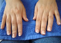 Как проводится профилактика грибковых заболеваний ногтей, её причины возникновения и лечение