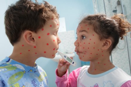 Детские вирусные заболевания: что делать и как лечить?